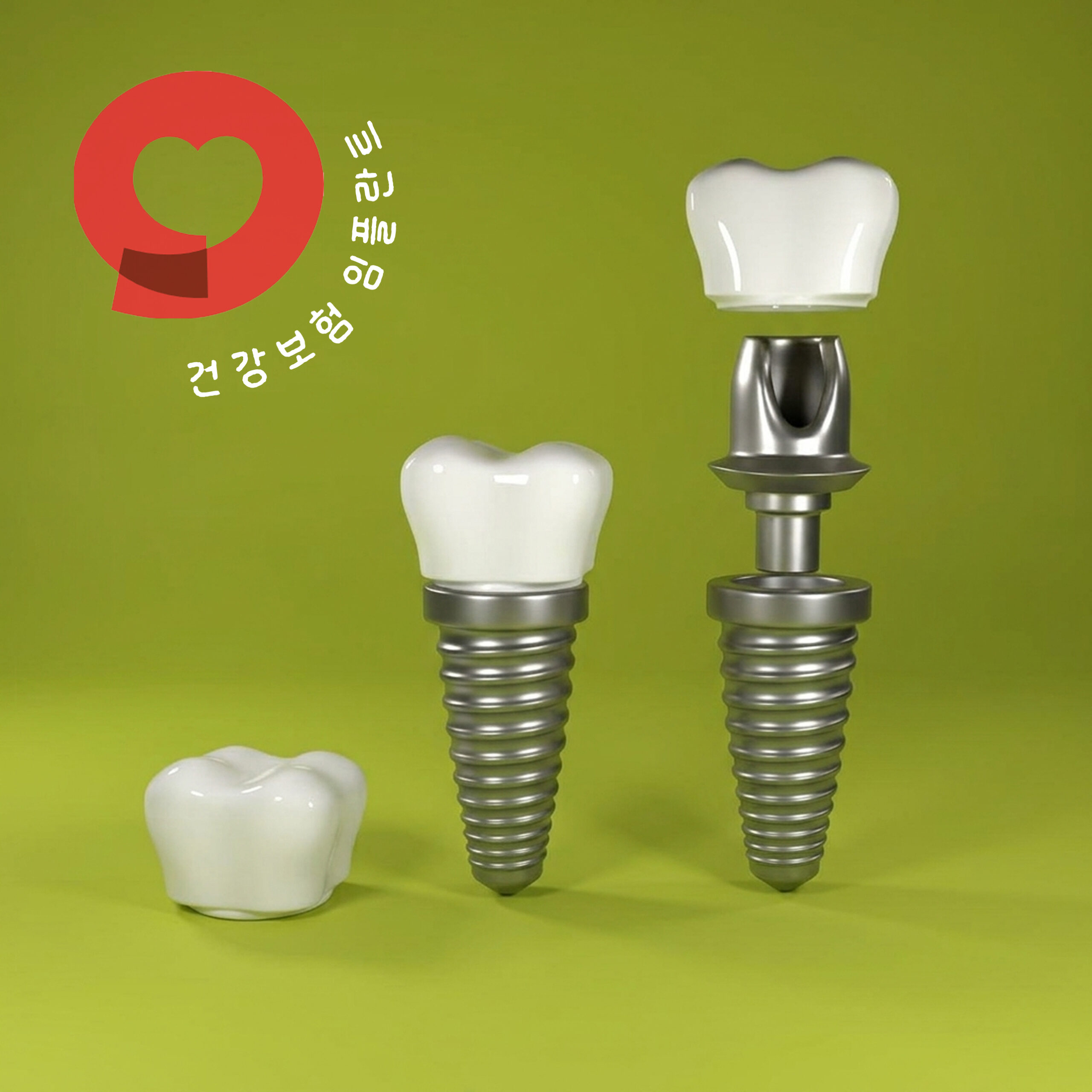 비전동치과 2027 무치악 건강보험 임플란트 급여 조건